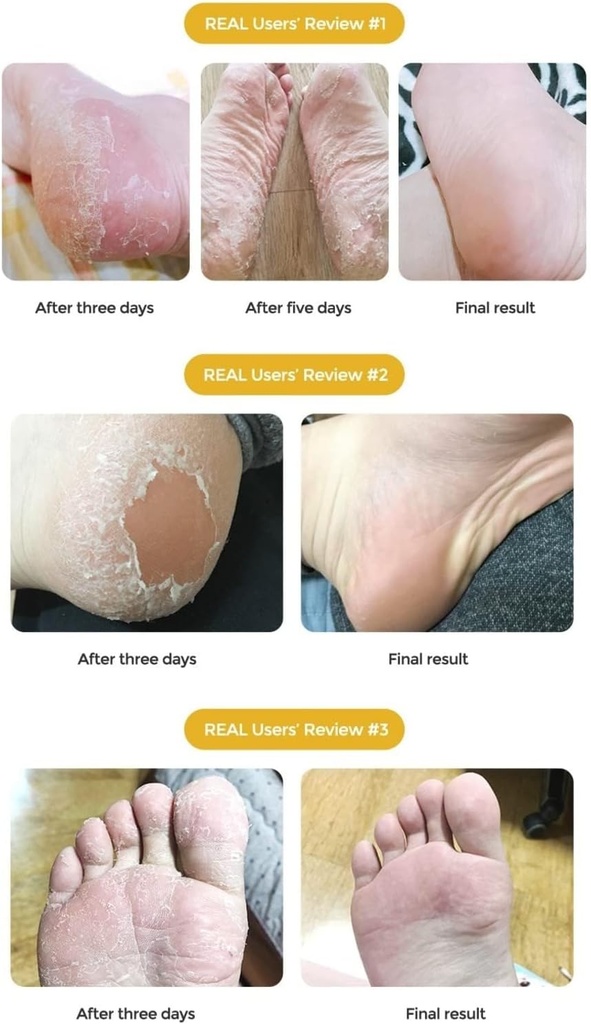 Pure Derm Exfoliating Foot Mask